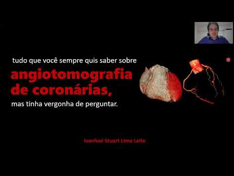 Vídeo: Angiografia Por Tomografia De Coerência óptica Na Retinopatia Diabética: Uma Revisão Das Aplicações Atuais