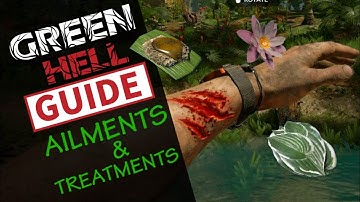 GREEN HELL 2025 / BEGINNERS GUIDE: TREATMENTS, HEALTH & HEALING