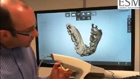 Scanning Stone Models with 3Shape TRIOS
