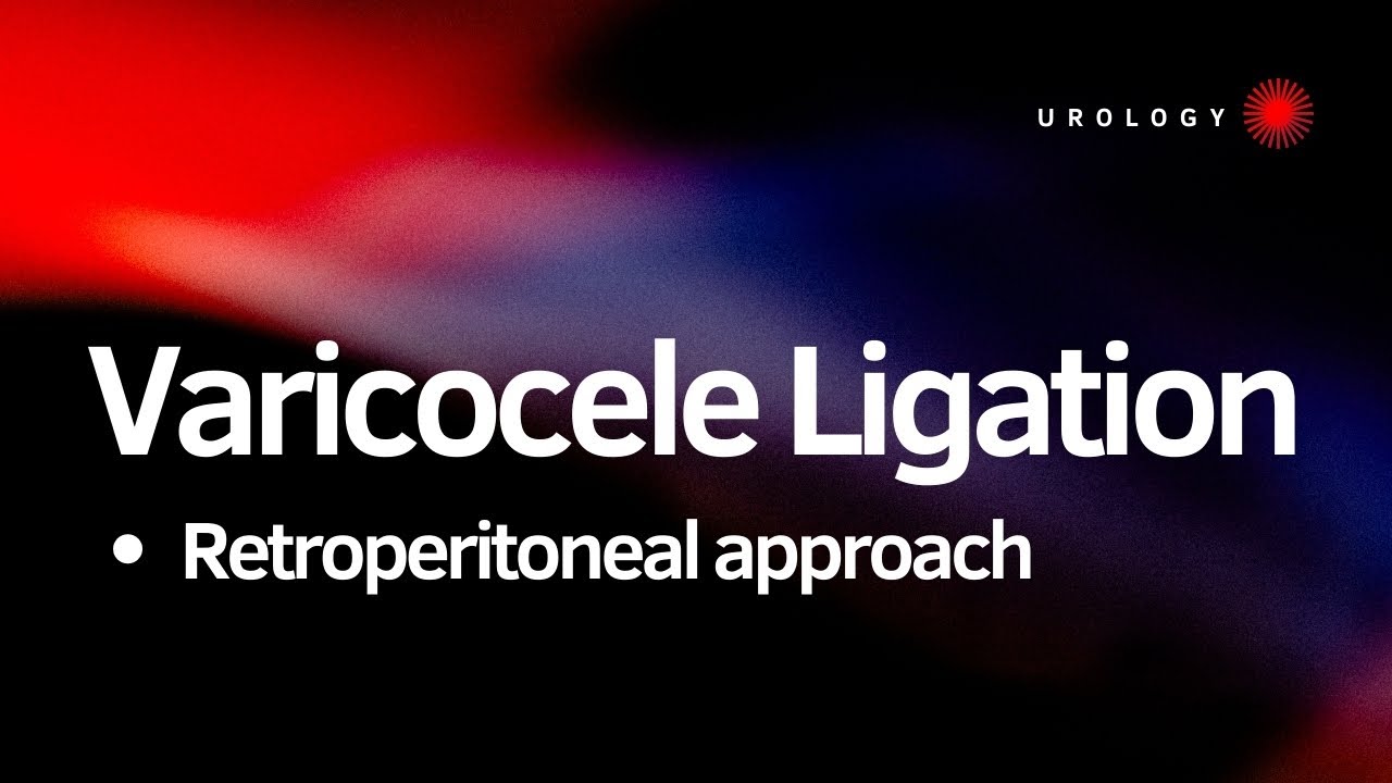 Step-by-Step Retroperitoneal Varicocelectomy