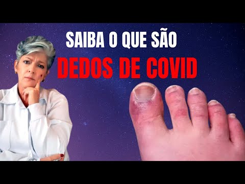 Vídeo: Os dedos dos pés do covid estão coçando?