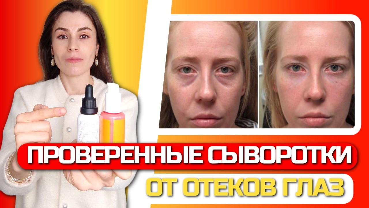 ЭТИ СЫВОРОТКИ ТОЧНО РАБОТАЮТ! Убери ОТЕК и мешки нижних век! Лучший уход для глаз. Кремы от отеков