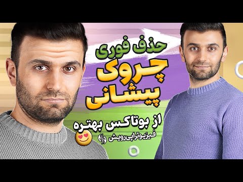 تصویری: 4 راه برای از بین بردن چین و چروک پیشانی