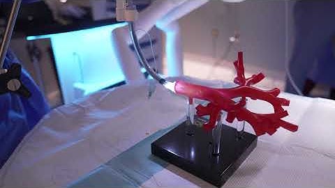 Monarch: Robotic-Assisted Bronchoscopy