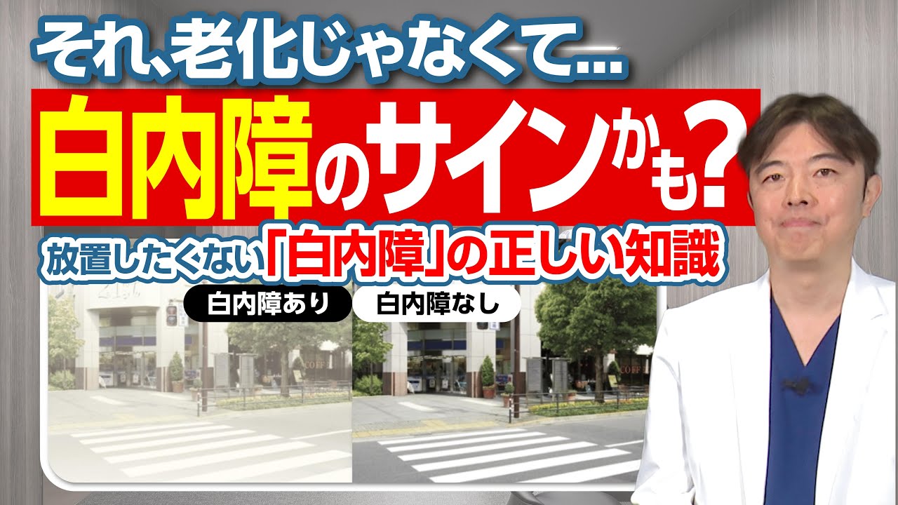 それ、老化じゃなくて白内障のサインかも？放置したくない「白内障」の正しい知識！