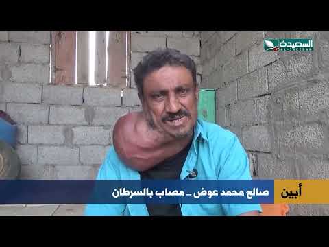 مريض يمني يناشد لإنقاذ حياته من سرطان متفاقم