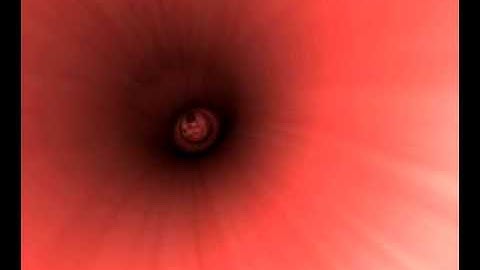 Upper Endoscopy - The Procedure