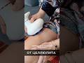 Как избавиться от целлюлита? Банки!