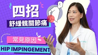 脊醫王鳳恩 四招舒緩髖關節痛,常見原因Hip Impingement(中/Eng Sub)Hip Impingement hip pain  Dr.Matty Wong Chiropractor