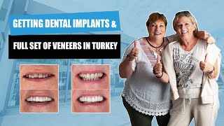 Getting Full Set of Veneers in Turkey with Dental Implants 2021 | Myra Dental Centre Turkey