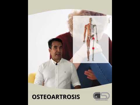 Vídeo: La osteoartritis es pot classificar com a discapacitat?