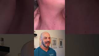 Derm reacts to the popping of deep cystic pimple! #dermreacts #doctorreacts #cysticpimple