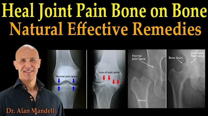 Heal Joint Pain Bone on Bone - Dr. Alan Mandell, D...
