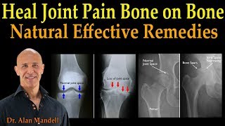 Heal Joint Pain Bone on Bone  Dr. Alan Mandell, D.C.