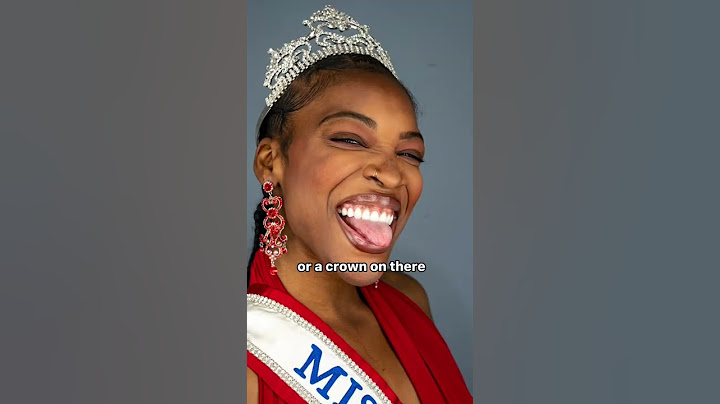 Veneers vs Crowns #shorts #crowns #dentalcare #teeth #veneers #cincinnati