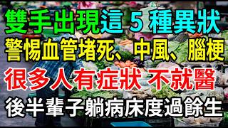 雙手出現這 5 種異狀，請立刻警覺！這是血管堵死的救命信號！中風、腦梗，後半輩子可要躺病床了！