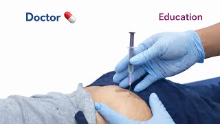 Intramuscular Im Injection Method Doctor Medicine