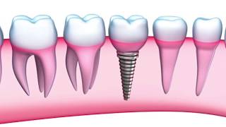Biocompatible Dentistry