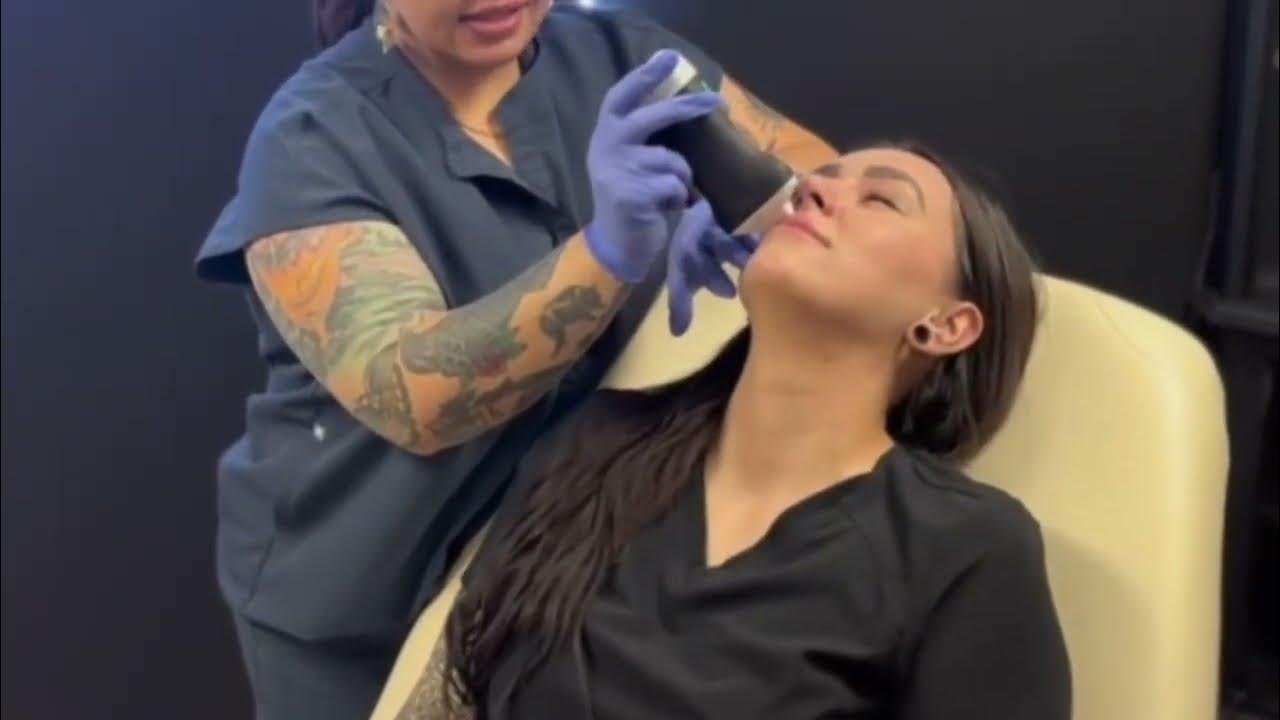 Using Ultrasound To Dissolve Filler YouTube using-ultrasound-to-dissolve-filler-youtube