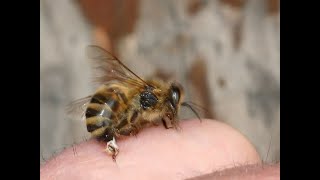 سبحان الله - تعرفى على العلاج بلدغات النحل - وسم النحل - وهواء خلية النحل -- فيه شفاء للناس