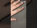اسباب ارتفاع الحرارة في السرعة وأهمية نظافة سربنتينة التكيف للمحرك واداء التكيف 