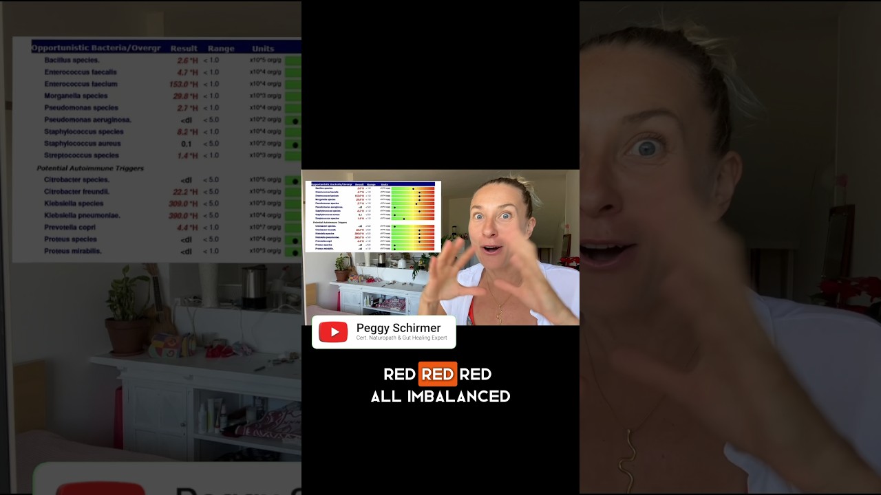 Do You Need Sea Moss to Heal Your Gut? 