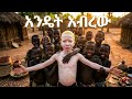 በአፍሪካ አልቢኖ መሆን አስፈሪ እውነታ 