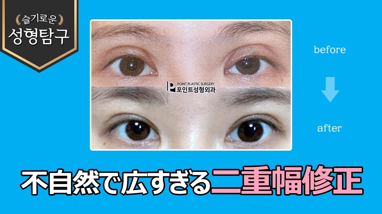 二 重 幅 広 すぎ 変