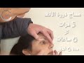طريقة مساج الأنف بعد عملية تجميل الأنف 