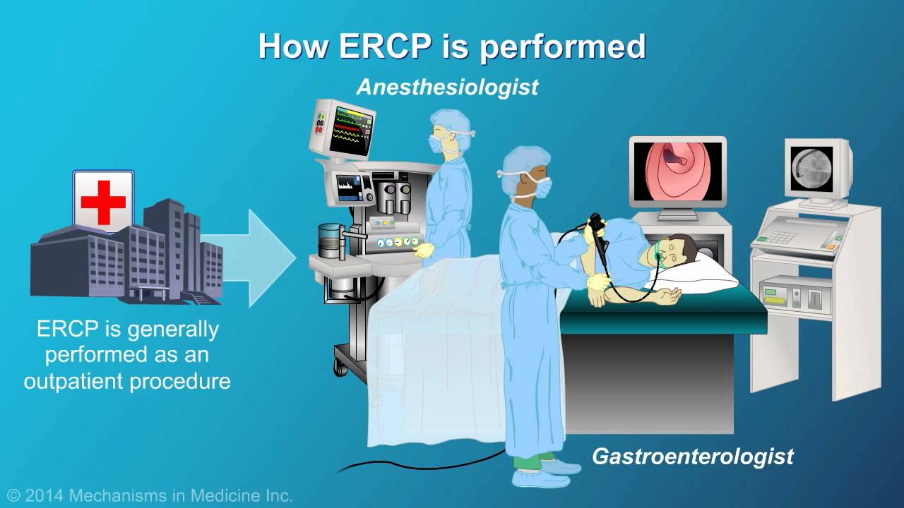 ERCP: What It Is, Why It's Done, Procedure & Complications