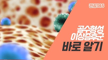 골수형성이상증후군 바로 알기 [TBC클리닉건강365]