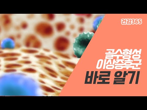 골수형성이상증후군 바로 알기 [TBC클리닉건강365]