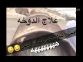 ابسرو هاذا أفضل علاج للدوخة في اليمن 