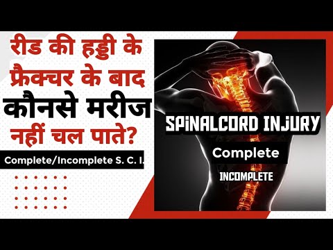 वीडियो: हड्डी के फ्रैक्चर से कैसे उबरें: 12 कदम (चित्रों के साथ)