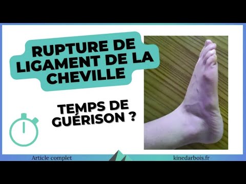 Vidéo: Où se situe le ligament calcanéo-fibulaire ?