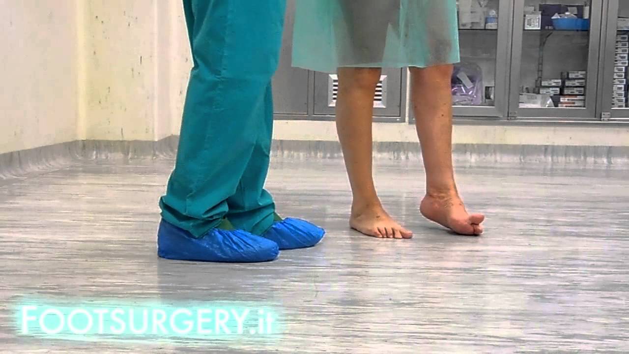 Paralityc Drop Foot post stroke syndrome YouTube