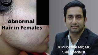 Abnormal Hair Growth on Face in Females | Dr Mubashar Mir | Dermatologist