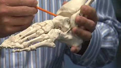 Ankle Arthritis - Dr. Douglas Wyland