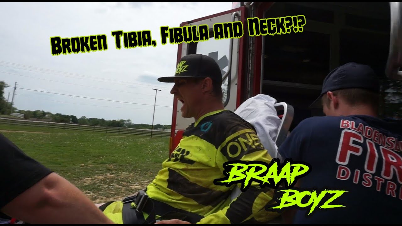 2 Braap Boyz Down | Broken Tib Fib and Neck!