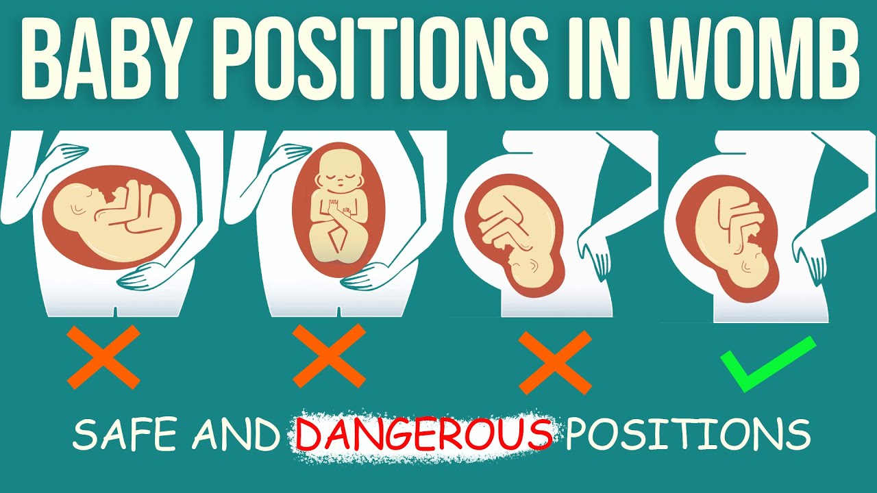 Baby Positions During Pregnancy YouTube Baby Positions During Pregnancy YouTube