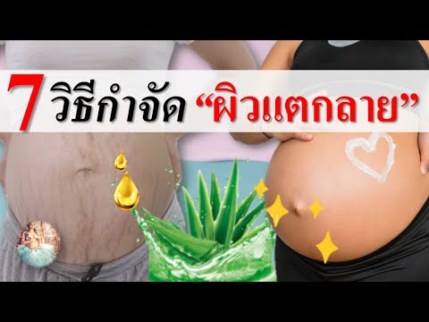 ลด รอย แตก ลาย หลัง คลอด  New  รอยแตกลาย : 7 วิธีกำจัดผิวแตกลาย | การดูแลคนท้อง | คนท้อง Everything