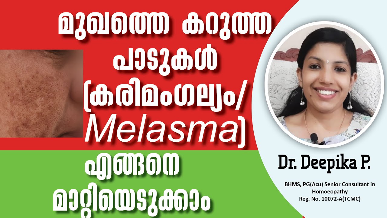 കരിമംഗല്യം വീട്ടിൽ തന്നെ മാറ്റാൻ എളുപ്പവഴി| മുഖത്തെ കറുത്തപാടുകൾ മാറാൻ| Karimangalyam | pigmentation