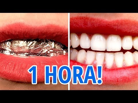 Vídeo: Inacreditável! O Bicarbonato De Sódio Remove Olheiras E Bolsas Sob Os Olhos