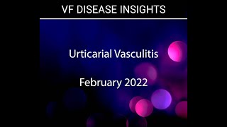 Urticarial Vasculitis  Overview