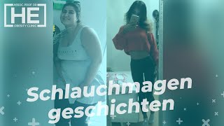 Magenverkleinerung Türkei | Berna hat 74 kg abgenommen in 1 Jahren durch eine Schlauchmagen Op