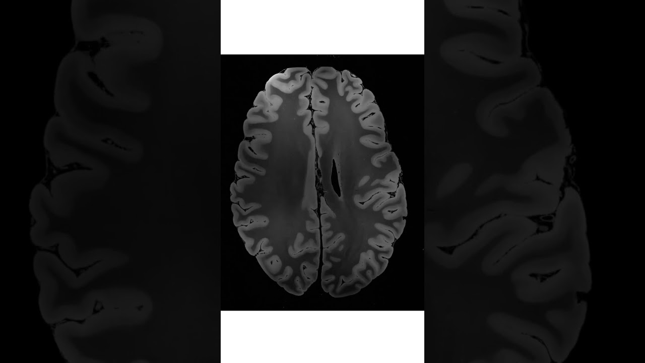 7 Tesla MRI dataset of an ex vivo Human Brain Specimen 😮😮    