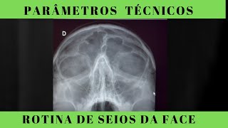 Radiografia De Seios Da Face- Como Saber Se Meu Exame Ficou Bom? Anatomia Radiológica