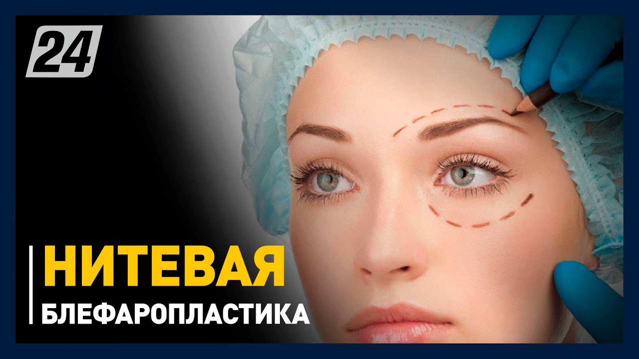 Нитевая блефаропластика. Стоит ли она своих денег?
