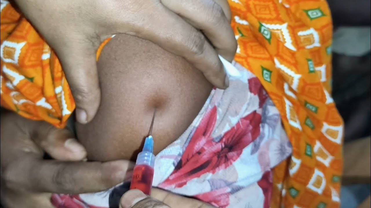 Must Watch Vitamin B1,B6,B12 im Injection Video Ep _51 Injection Vision ...