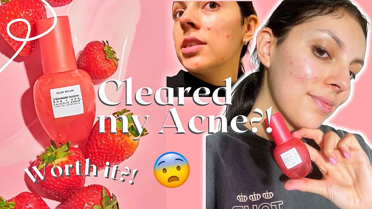 Cleared My ACNE Glow Recipe Strawberry Smooth BHA AHA Salicylic cleared-my-acne-glow-recipe-strawberry-smooth-bha-aha-salicylic